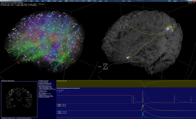 SpikeFun_BrainView"